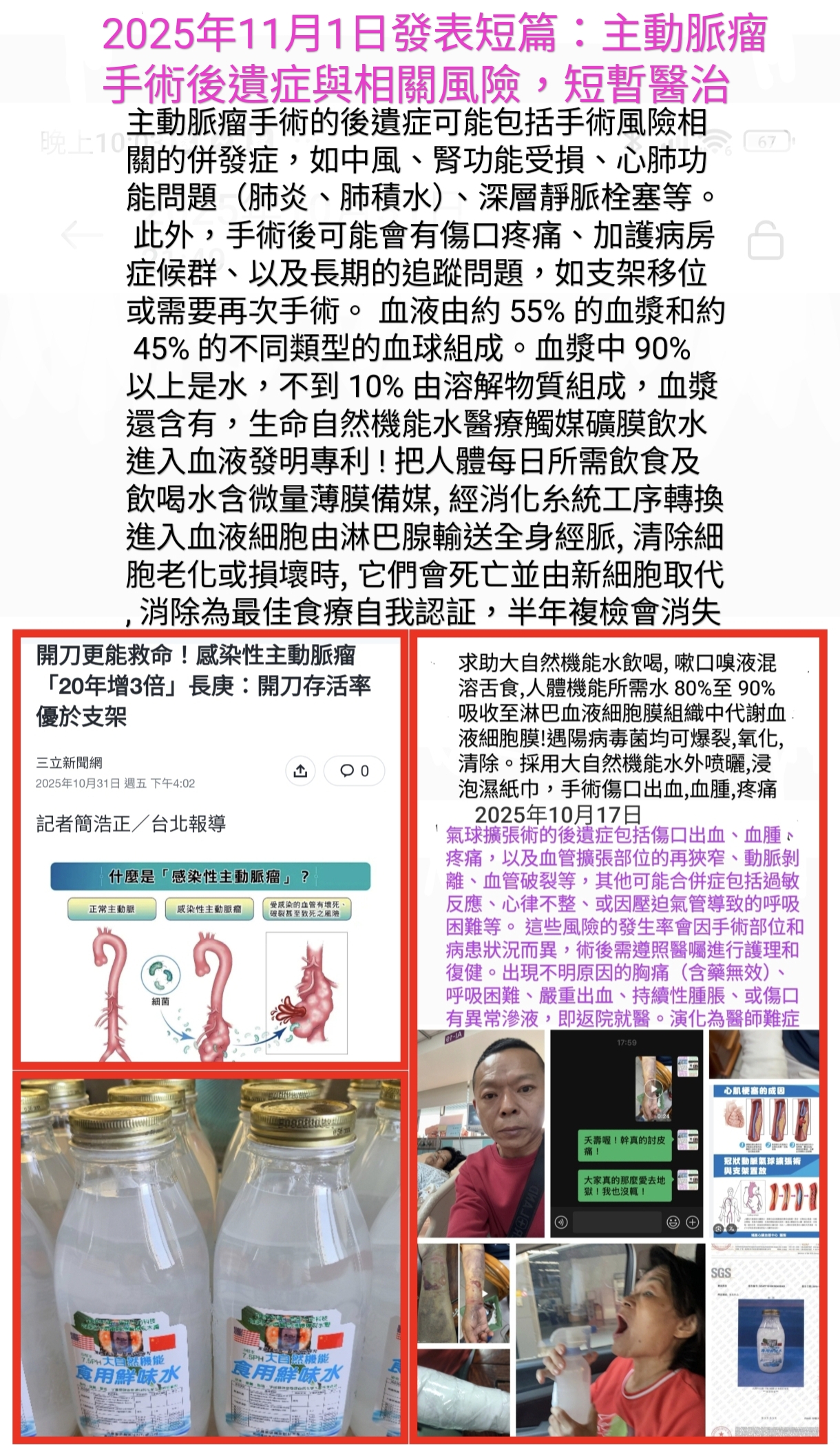 主動脈瘤手術後遺症與相關風險 主動脈瘤手術後遺症與相關風險