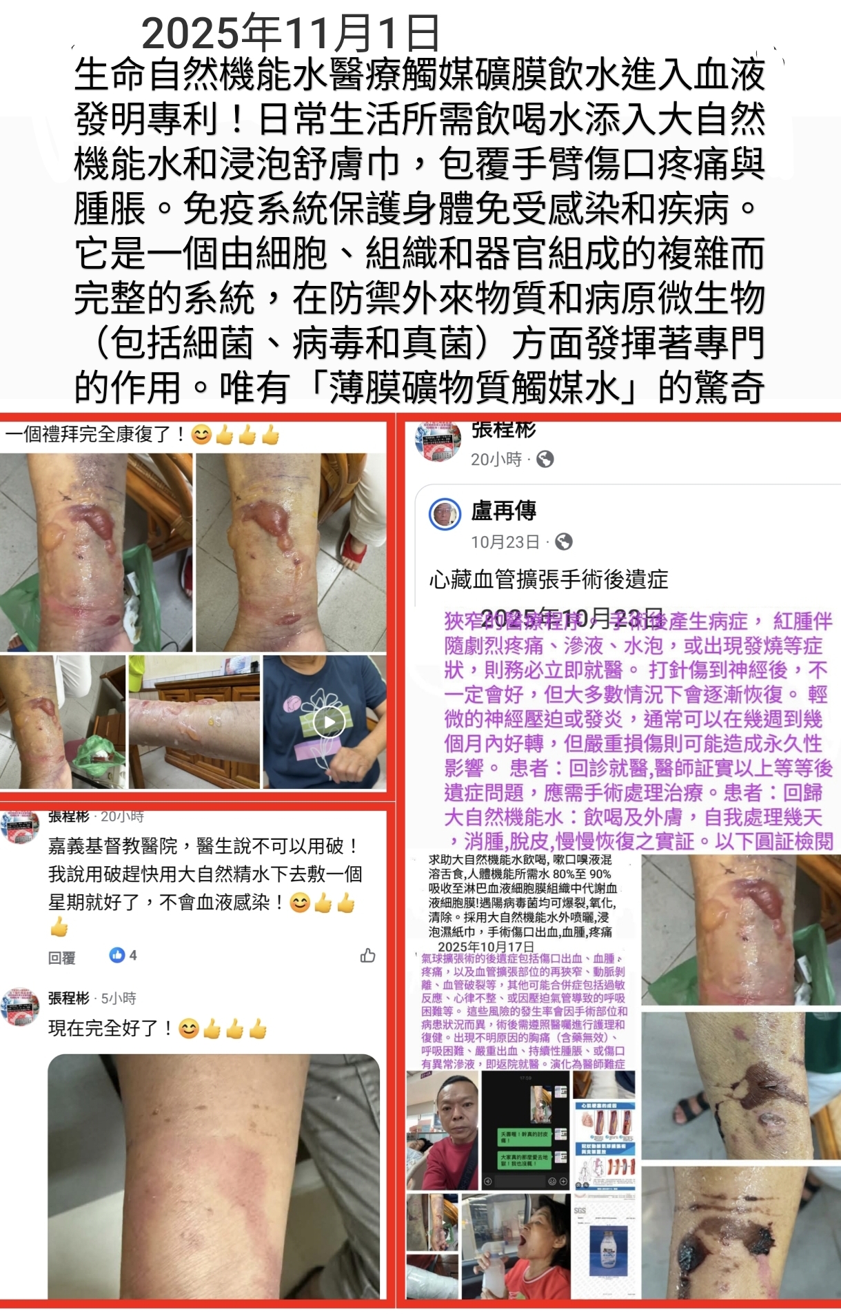 免疫系統保護身體免受感染和疾病