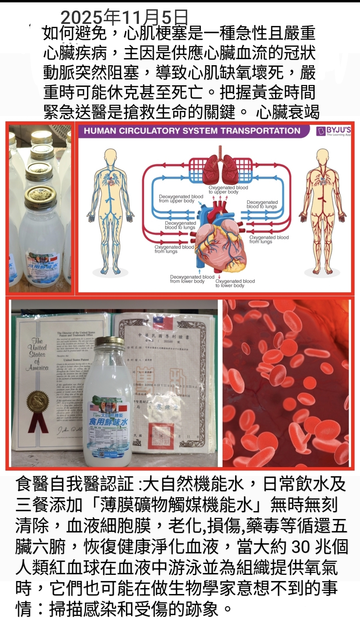 如何避免，心肌梗塞是一種急性且嚴重心臟疾病